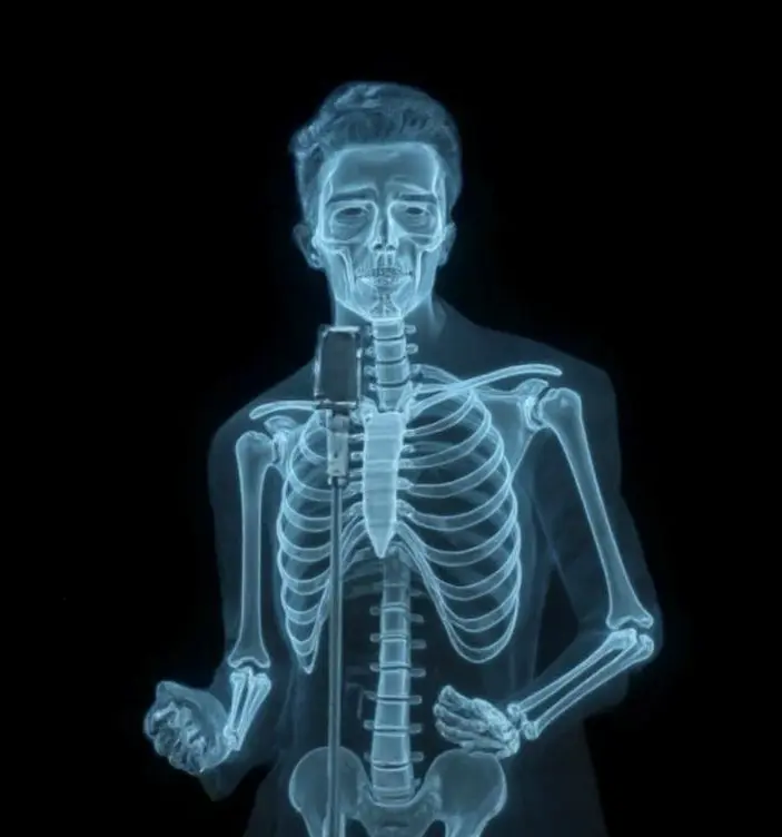 X-ray